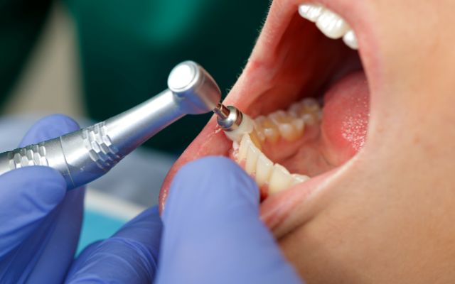 プロフェッショナルケア